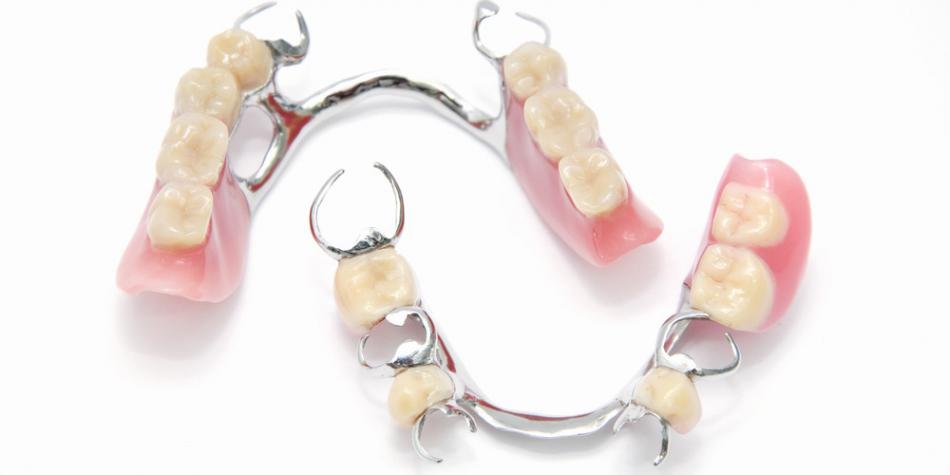 Съемные зубные протезы: виды и особенности, показания к установке
